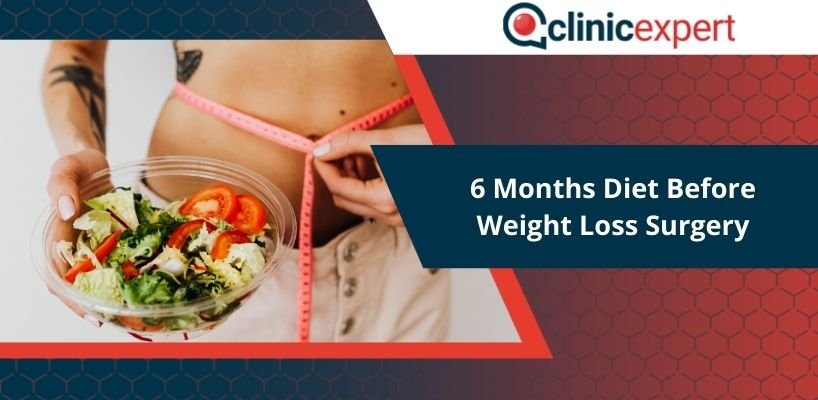 How a 6 Month Diet Can Prepare You for Weight Loss Surgery